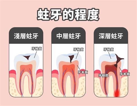 牙齒丟哪裡 宅主